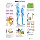 Osteoporosis Chart, 1001472 [VR1121L], Sistema Scheletrico