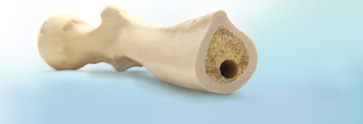 Modelli ossei ortopedici