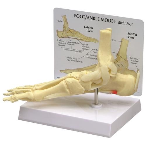 Modello di piede/caviglia con fascite plantare, 1019522, Modelli di scheletro del piede e della gamba
