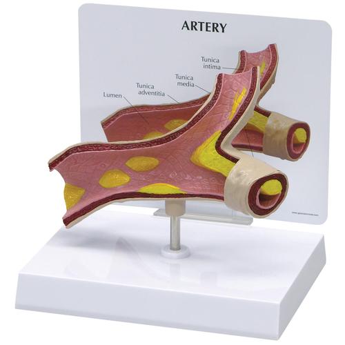 Modello di arteria, 1019531, Modelli di Cuore e Apparato Circolatorio