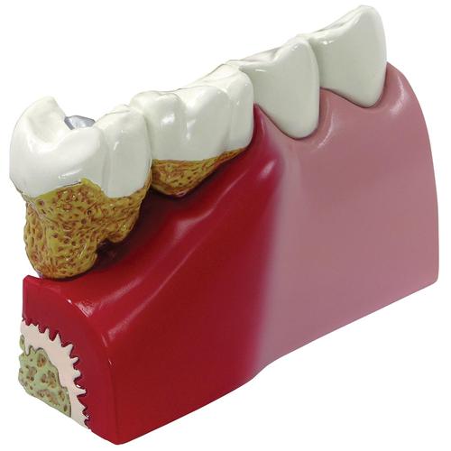 Modello di denti, 1019539, Modelli Dentali