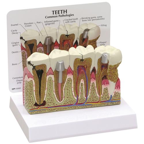 Modello di denti, 1019539, Modelli Dentali