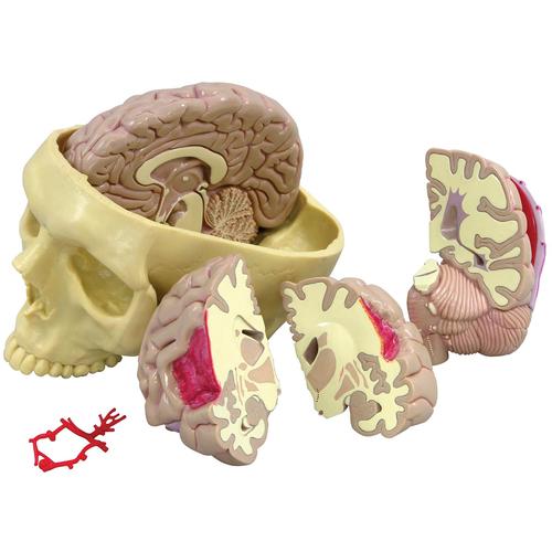 Modello di cervello, 1019542, Modelli di Cranio