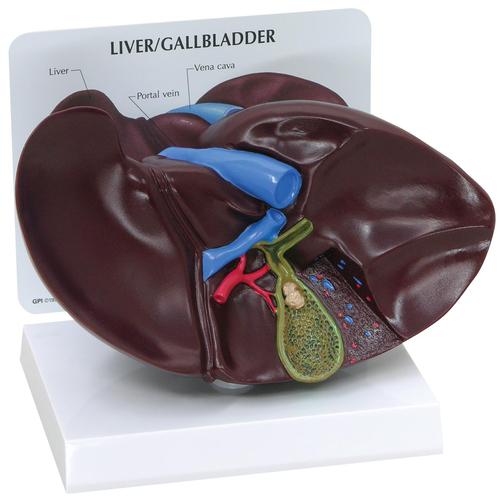 Modello di fegato/cistifellea con calcoli biliari, 1019551, Modelli di Sistema Digerente
