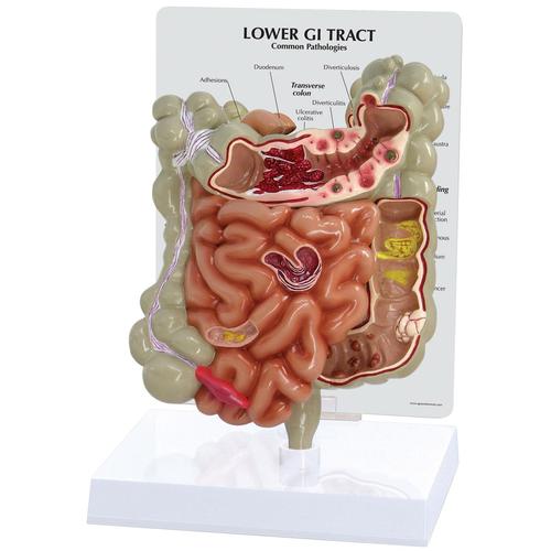 Modello di tratto gastrointestinale, 1019556, Modelli di Sistema Digerente