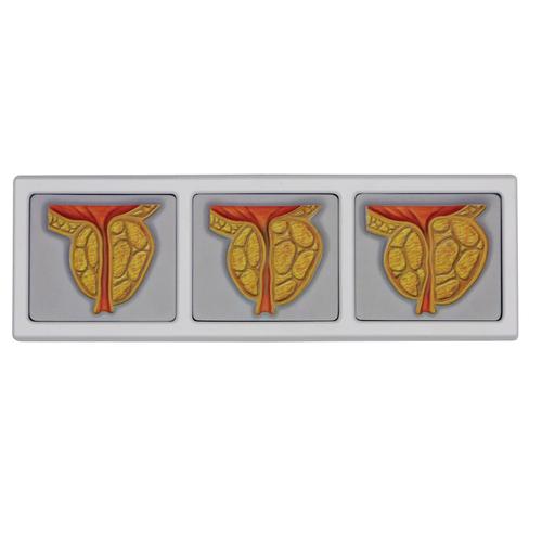 Pelvi maschili con prostata in 3D, 1019563, Modelli di Pelvi e Organi genitali