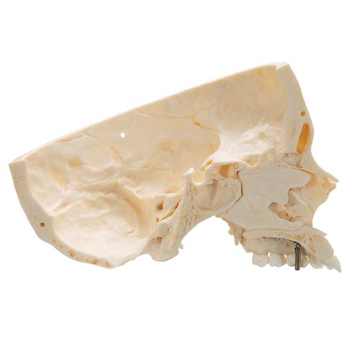 BONElike Cranio - cranio combinato, trasparente/osseo, in 8 parti - 3B Smart Anatomy, 1000063 [A282], Modelli di Cranio