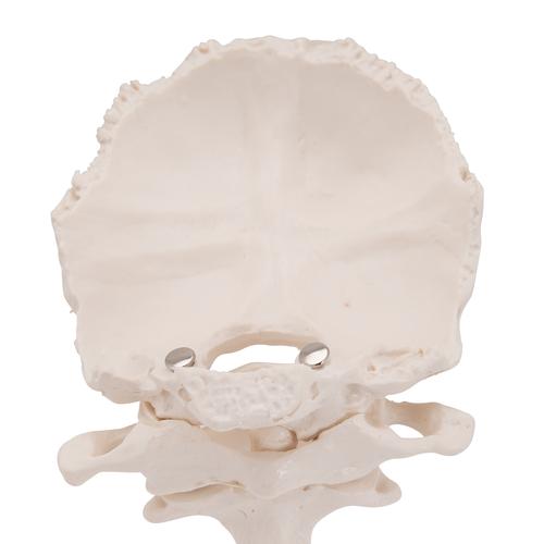 Atlante e epistrofeo, con squama dell’osso occipitale - 3B Smart Anatomy, 1000142 [A71/5], Modelli singoli di ossa