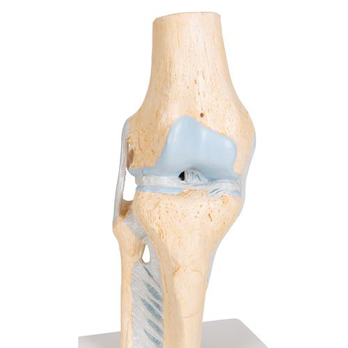 Modello della sezione articolare del ginocchio, in 3 parti - 3B Smart Anatomy, 1000180 [A89], Modelli delle Articolazioni