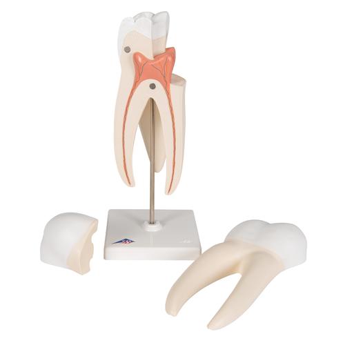 Dente molare superiore a tre radici, in 3 parti - 3B Smart Anatomy, 1017580 [D10/5], Ricambi