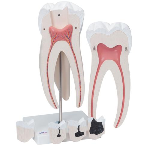 Dente molare superiore a tre radici, in 6 parti - 3B Smart Anatomy, 1013215 [D15], Modelli Dentali