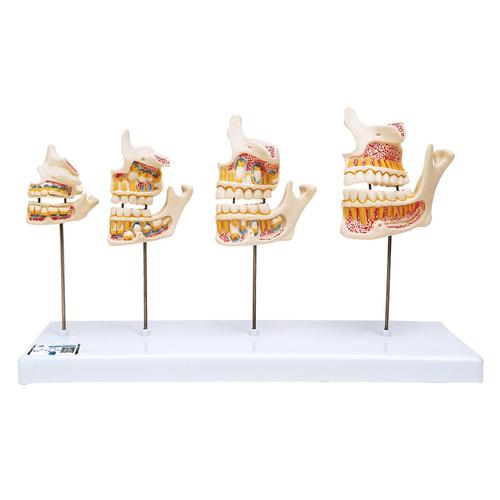 Sviluppo della dentatura - 3B Smart Anatomy, 1000248 [D20], Modelli Dentali