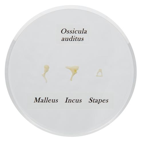 Ossicini dell’orecchio, a grandezza naturale, 1000253 [E13], Modelli di Orecchio, Naso e Gola