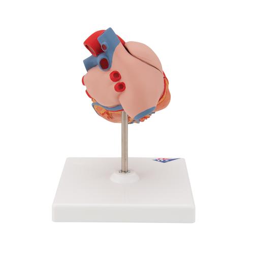 Cuore, modello classico con ipertrofia ventricolare sinistra, in 2 parti - 3B Smart Anatomy, 1000261 [G04], Modelli di Cuore e Apparato Circolatorio