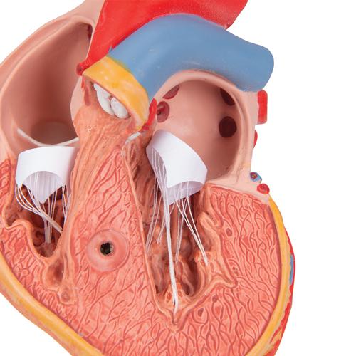Cuore, modello classico con ipertrofia ventricolare sinistra, in 2 parti - 3B Smart Anatomy, 1000261 [G04], Modelli di Cuore e Apparato Circolatorio