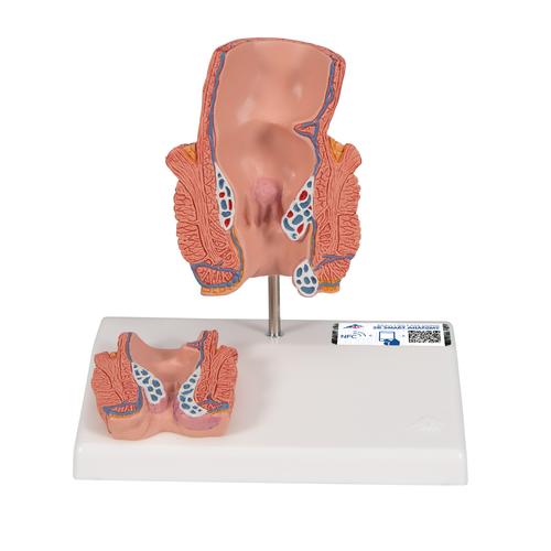 Modello di emorroidi - 3B Smart Anatomy, 1000315 [K27], Modelli di Sistema Digerente