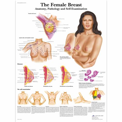 Modello per palpazione del seno, da appendere, 1000342 [L50], Women's Health Education