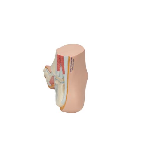 Piede cavo (Pes cavus) - 3B Smart Anatomy, 1000356 [M32], Modelli delle Articolazioni