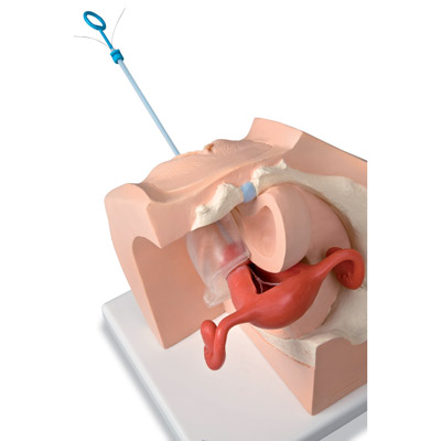 Modello ginecologico per colloquio con i pazienti - 3B Smart Anatomy, 1013705 [P53], Women's Health Education