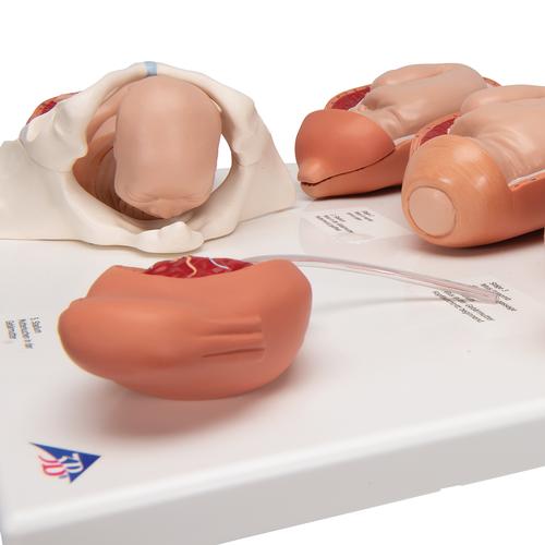 Modello delle fasi della nascita - 3B Smart Anatomy, 1001259 [VG393], Modelli Gravidanza
