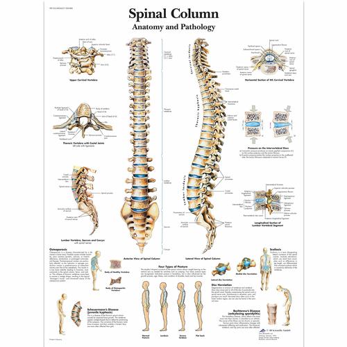 Spinal Column - Anatomy and Pathology, 4006657 [VR1152UU], Sistema Scheletrico