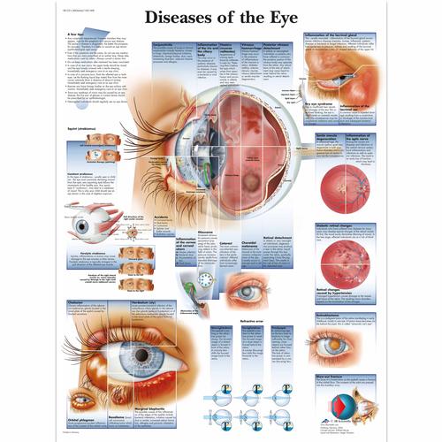 Diseases of the Eye, 4006666 [VR1231UU], Occhi