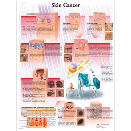 Skin Cancer, 1001514 [VR1295L], Cancro
