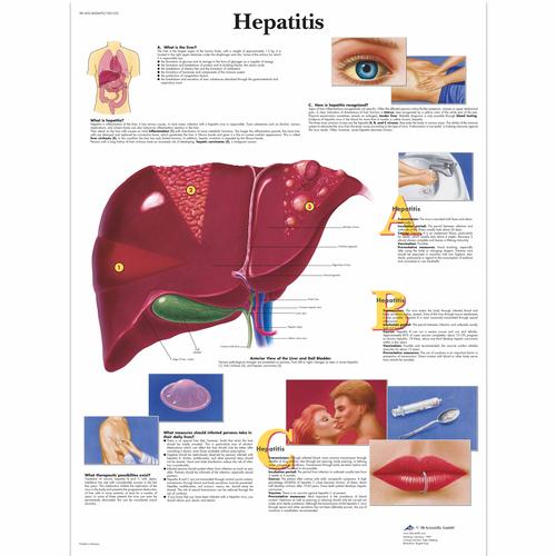 Hepatitis, 4006693 [VR1435UU], Sistema metabolico