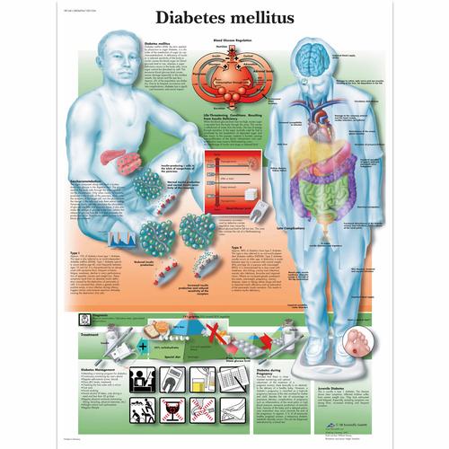 Diabetes mellitus, 4006694 [VR1441UU], Strumenti per l’istruzione al diabete