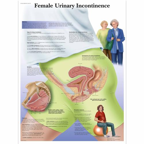 Female Urinary Incontinence, 1001570 [VR1542L], Ginecologia
