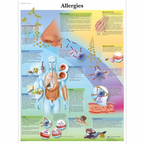 Allergies, 4006715 [VR1660UU], Sistema immunitario