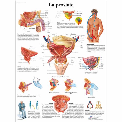La prostate, 4006783 [VR2528UU], Sistema urinario