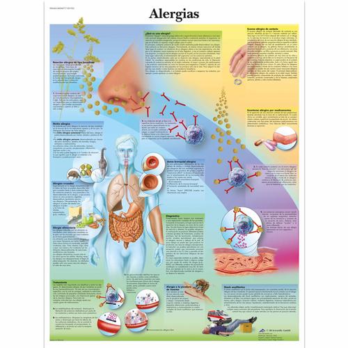 Alergias, 4006877 [VR3660UU], Sistema immunitario