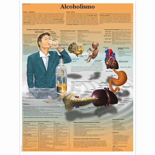 Alcoholismo, 4006891 [VR3792UU], Tossicodipendenza
