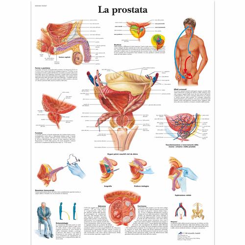 La prostata, 4006948 [VR4528UU], Sistema urinario