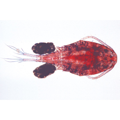 Crostacei (Crustacea), 1003860 [W13004F], Micropreparati LIEDER