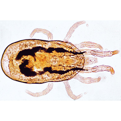 Aracnidi e miriapodi (Arachnoidea, Myriapoda), 1003864 [W13005F], Micropreparati LIEDER
