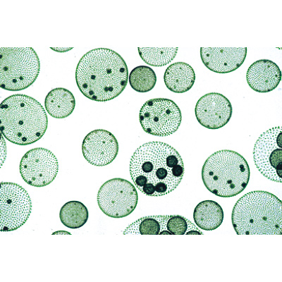 Alghe (Algae), 1003888 [W13012], Micropreparati LIEDER