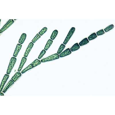 Alghe (Algae), 1003888 [W13012], Micropreparati LIEDER