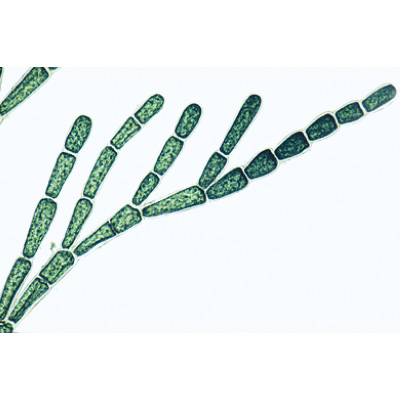 Alghe (Algae), 1003889 [W13012F], Micropreparati LIEDER