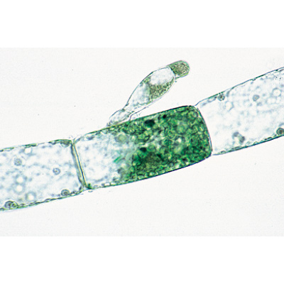 Alghe (Algae), 1003889 [W13012F], Micropreparati LIEDER
