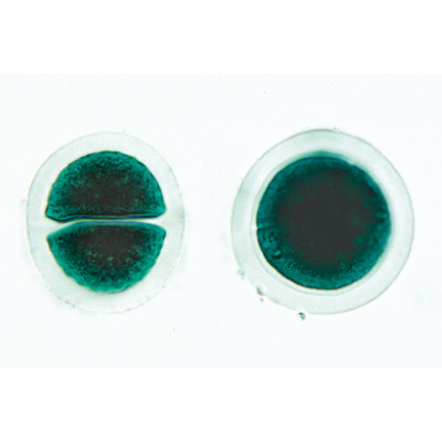 Alghe (Algae), 1003890 [W13012P], Micropreparati LIEDER