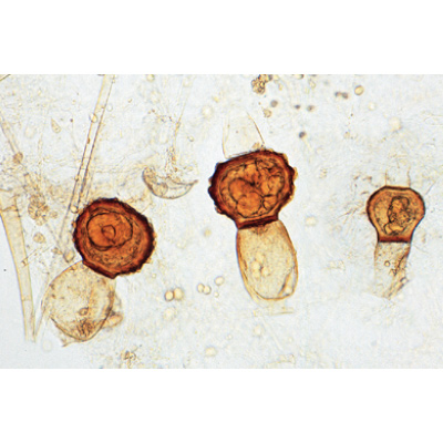 Funghi e licheni (Fungi, Lichenes), 1003892 [W13013], Micropreparati LIEDER