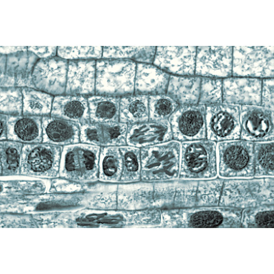 Fanerogame II. Cellule e tessuti - Tedesco, 1003908 [W13017], Micropreparati LIEDER