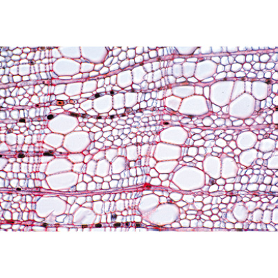 Fanerogame IV. Il tronco - Tedesco, 1003916 [W13019], Micropreparati LIEDER