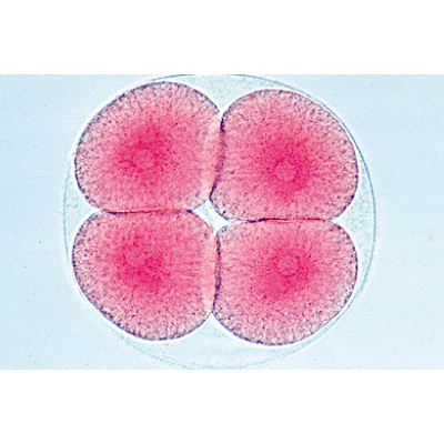 Evoluzione del riccio di mare (Psammechinus miliaris) - Tedesco, 1003944 [W13026], Micropreparati LIEDER