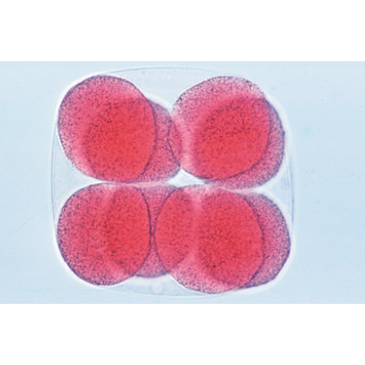 Evoluzione del riccio di mare (Psammechinus miliaris) - Tedesco, 1003944 [W13026], Micropreparati LIEDER