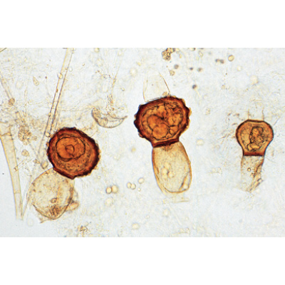 Funghi e licheni (Fungi, Lichenes), 1003971 [W13042], Inglese