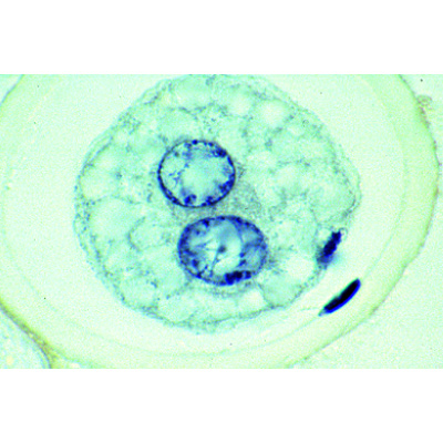 Ovulazione e fecondazione nel verme dei cavalli (Ascaris megalocephala), 10 preparati, con testo accompagnatorio completo (tedesco), 1013478 [W13084], Divisione cellulare