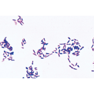 Batteri come agenti infettivi e patogeni, 1004146 [W13324], Micro Slides